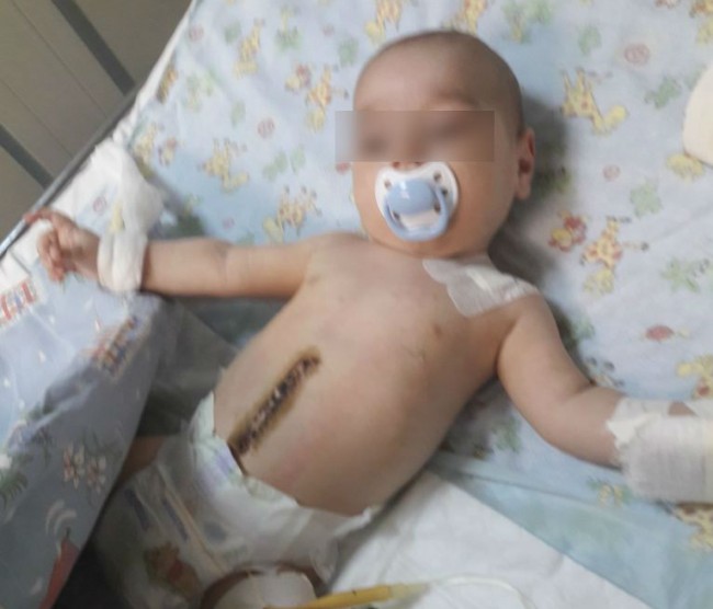 Смоленскому малышу срочно требуется помощь после клинической смерти