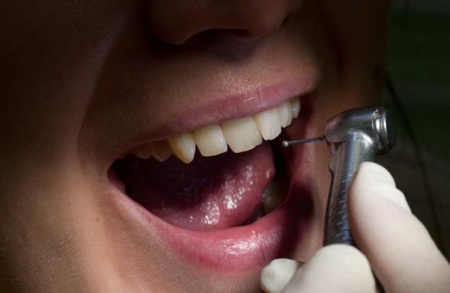 Как больные зубы разрушают организм