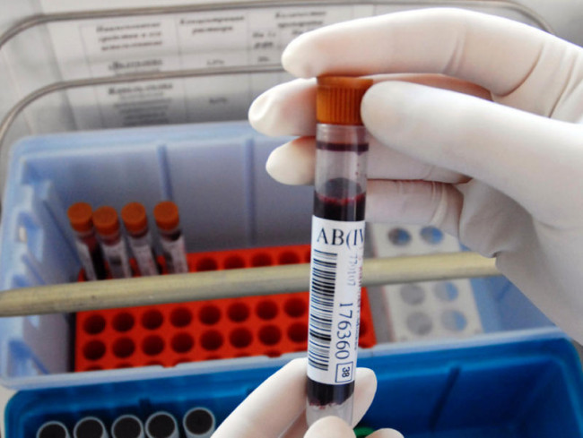 Медики назвали самую распространенную группу крови среди носителей онкологии