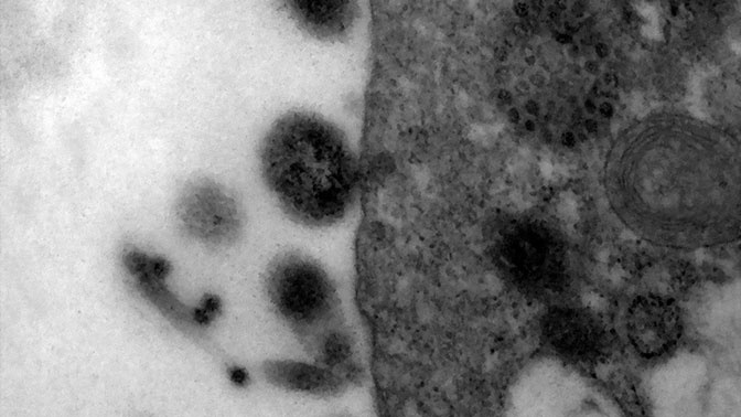 Ученые показали момент заражения COVID-19 под микроскопом