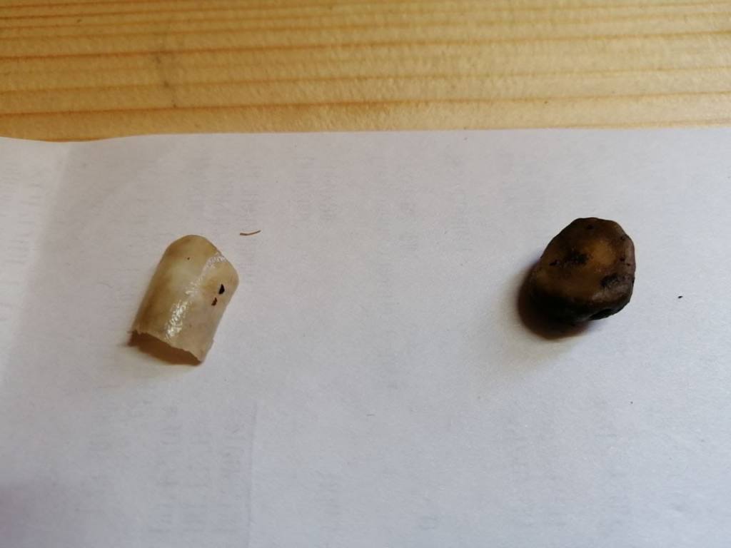 В демидовском лесу отец Влада Бахова нашел ноготь и кость своего ребенка