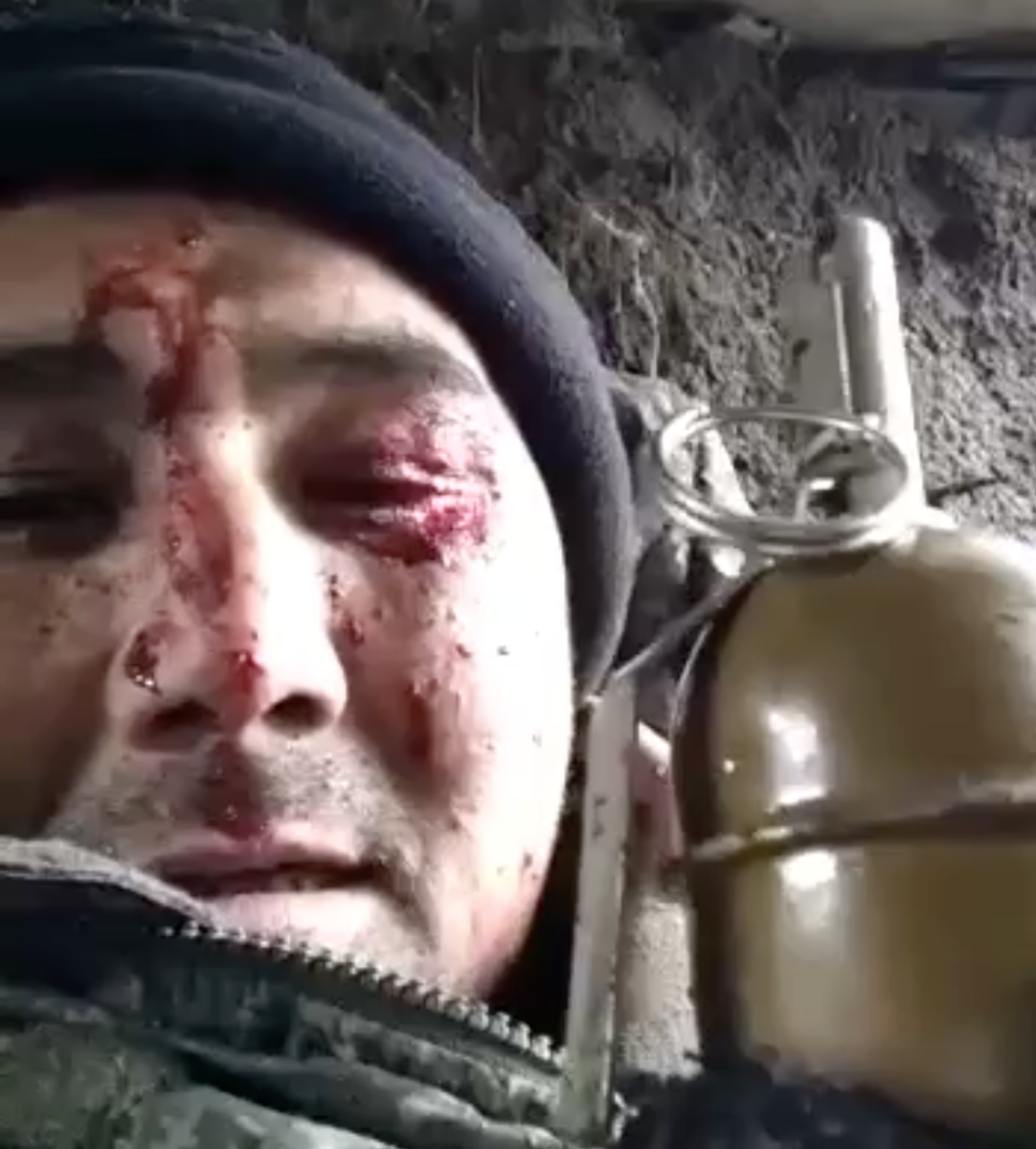 Раненый боец ВС России, готовый подорвать себя гранатой, чтобы не сдаваться в плен, оказался жив